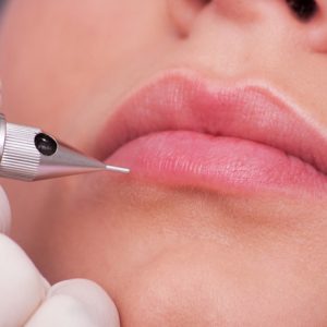 Môi đã phun xử lý lại