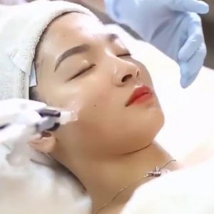 Cấy Colagen tươi