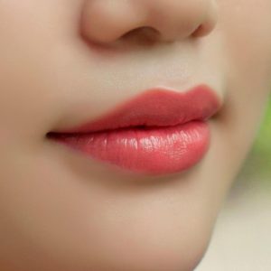 Phun môi công nghệ Châu Âu (Collagen tươi hoặc tế bào gốc)