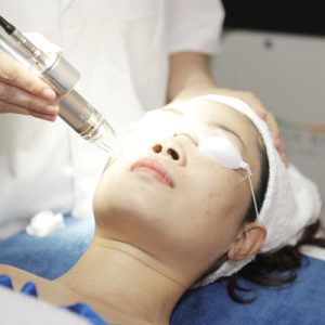 ĐIều trị bằng laser cao cấp