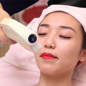Triệt ria mép